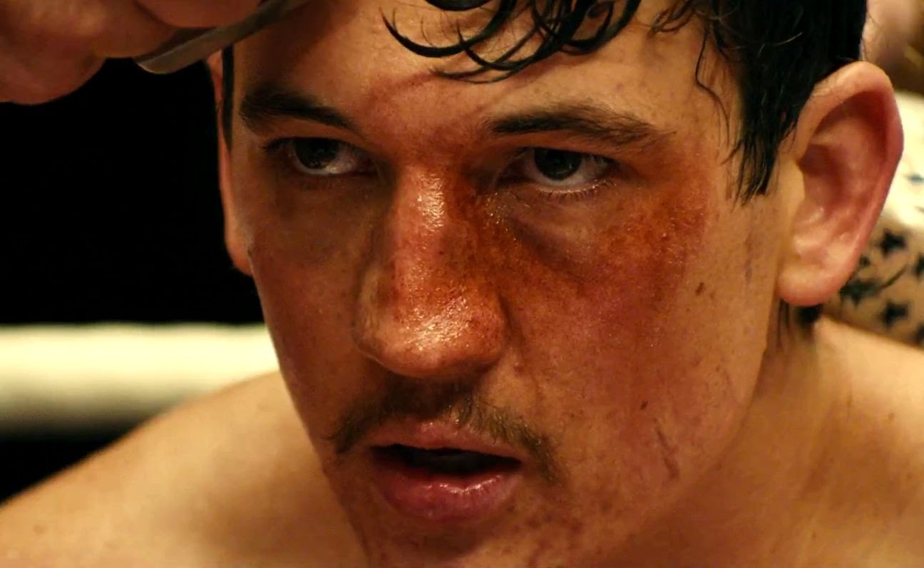 Bleed For This